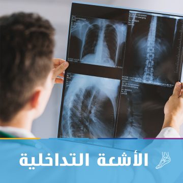 الأشعة التداخلية بالمنزل